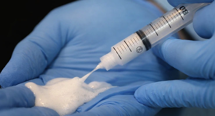 espuma densa para varizes