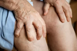 Trombose em viagens longas: riscos e prevenção Palavra-chave: trombose em viagens longas
