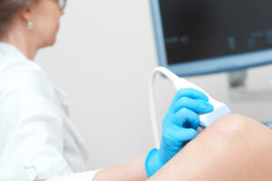 O papel do ultrassom Doppler no diagnóstico de doenças vasculares